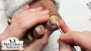 Pedicure Tutorial How to Relieve Pain in Your Toenails [upl. by Ihsar]