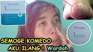 SEMOGE KOMEDO AKU ILANG  Cara Menghilangkan Komedo pake Wardah Acnederm [upl. by Blackmore]