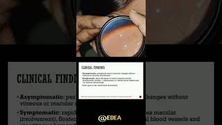 Retinal vasculitis viralvideo trending science eyes eyedea [upl. by Meeker598]