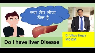 Liver Disease Symptoms in Hindi लीवर की बीमारी के लक्षण Dr Vikas Singla [upl. by Notsnhoj]