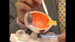 Retinal Tears Explain By Dr Niteen Dedhia  Ojas Eye Hosital [upl. by Naldo]