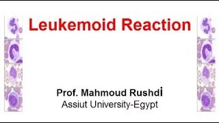 Leukemoid Reaction Arabic 2017 [upl. by Hilten200]