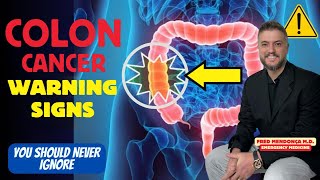 Does red meat cause colon cancer Colon Cancer Symptoms You Should Ignore [upl. by Pollyanna]