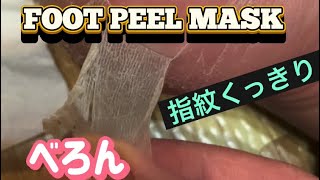 【peeling the foot】足裏角質パック皮剥き【skin peel】【पैर छीलना】3 角質除去 [upl. by Ardnola]