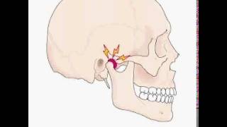 TRAUMA OCLUSAL [upl. by Elehcor]