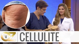 An Easy Exercise That Can Help Remove Cellulite [upl. by Wallie]