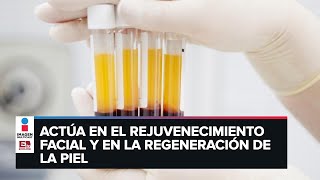 Estos son los beneficios del plasma rico en plaquetas [upl. by Booker]