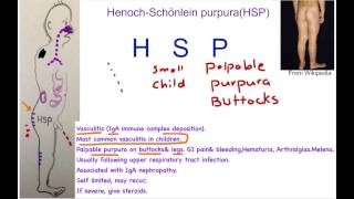 HenochSchönlein Purpura Mnemonic [upl. by Leddy]