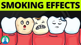 What are the Effects of Smoking on Oral Health [upl. by Eicrad]