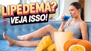 LIPEDEMA  Esses alimentos podem não estar ajudando [upl. by Calica670]