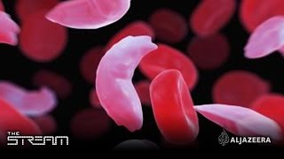 The Stream  Living with sickle cell anemia [upl. by Soren751]