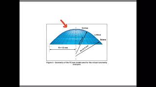 Keratometry  2nd grade  Instruments [upl. by Brittan]