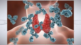 Understanding Autoimmune Thyroid Disease [upl. by Norris324]