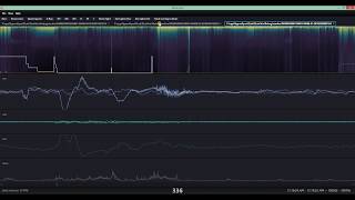 ZLab Sleep Study Management Software demo [upl. by Giwdul]