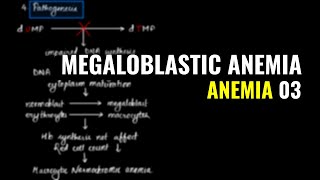 Megaloblastic Anemia  Schilling Test  Anemia 03  Pathology MBBS IOM [upl. by Leonard]