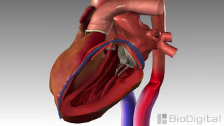 3D Medical Animation  Congestive Heart Failure [upl. by Hattie734]