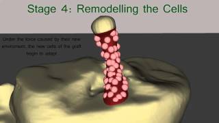 The Healing Process of the ACL Graft [upl. by Meisel]