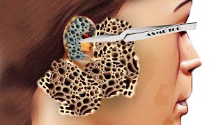 ASMR Ear Cleaning Animation treatment [upl. by Annelg]