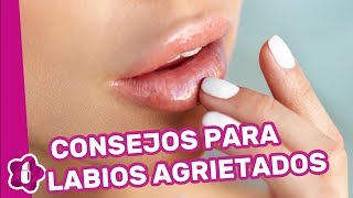 Labios agrietados consejos para que no se pelen tus labios [upl. by Fatsug]