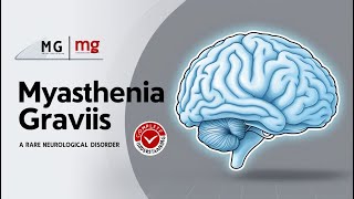 Myasthenia Gravis  Causes  Symptoms  Treatments DrTahirRasoolMD [upl. by Werner]