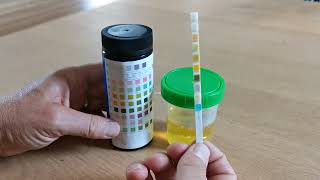 How to use urine test strips 10 parameters [upl. by Whorton844]