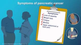 Pancreatic Cancer Signs Symptoms and Risk Factors [upl. by Franciska]