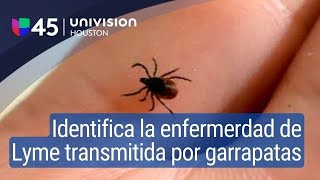 Aprende a identificar los síntomas de la enfermedad de Lyme transmitida por las garrapatas [upl. by Ellezig352]