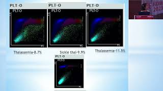 Automated FRC Count in Mindray BC6200  Effect of Microcytosis and Poikilocytosis [upl. by Elmore]