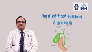 Symptoms of Gallbladder Stones  Dr Neeraj Goel Hindi [upl. by Relyuhcs]