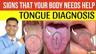 Signs That Your Body Needs Help  Tongue Diagnosis  Dr Vivek Joshi [upl. by Nomaj]