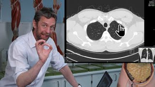 Thorax transverse CT imaging [upl. by Gabi]