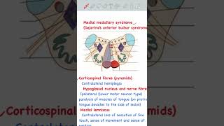 Medial Medullary Syndrome usmlestep usmlepreparation usmlestep1 [upl. by Darom708]