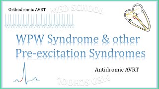 WPW Syndrome amp other preexcitation syndromes [upl. by Gayelord]