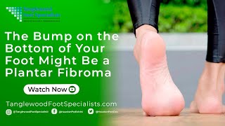 The Bump on the Bottom of Your Foot Might Be a Plantar Fibroma [upl. by Akenom]