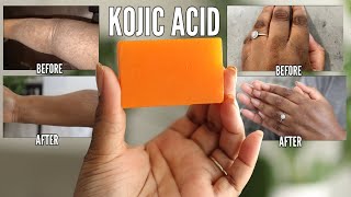 KOJIC ACID SOAP  How to lighten dark spots and get the best results [upl. by Crowley878]