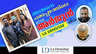 Actor Arjun Somasekars Hair Transplantation La Densitae Hair Clinic hair transplantation malayala [upl. by Ahseinod]