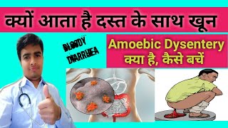 Bloody Diarrhea ll खूनी दस्त होना ll Amoebic Dysentery  दस्त के साथ खून आना  पेचिश [upl. by Ping]