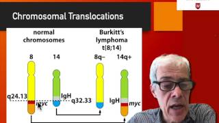 25 The case of Burkitt’s lymphoma [upl. by Lathrope]