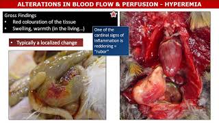 Circ Hyperemia and Congestion [upl. by Eenwahs]