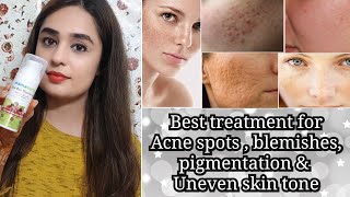 Best Face Cream for BlemishesPigmentation  Acne scars amp Uneven skin toneफाउंडेशन से पहले इसे लगाए [upl. by Ayrotal810]