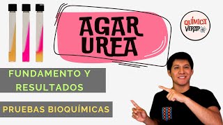 PRUEBA BIOQUIMICA UREA PRUEBA DE UREASA FUNDAMENTO Y RESULTADOS l PRUEBAS BIOQUIMICAS MICROBIOLOGIA [upl. by Salinas]