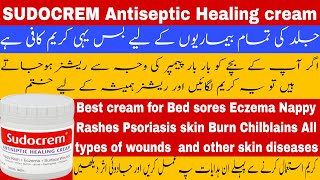 Sudocrem antiseptic healing cream  Nappy Rashes cream  baby rashes cream  fast rashes healing [upl. by Nrojb]