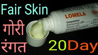 Lomela Cream आप को सिर्फ 20 दिन में Gora बना सकता है  लेकिन Fair Skin किस किमत पर [upl. by Rudelson104]