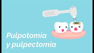 Diferencia entre pulpotomia u pulpectomia [upl. by Roddie]