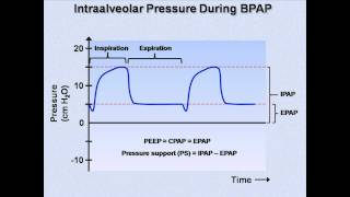 NonInvasive Positive Pressure Ventilation Mechanical Ventilation  Lecture 6 [upl. by Schatz]