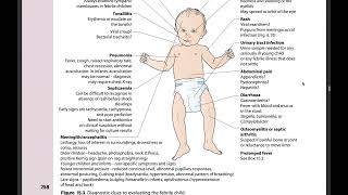 MRCPCH FOPTAS  READ ALONG CHAPTER 15 INFECTION amp IMMUNITY 1 ILLUSTRATED TEXTBOOK OF PEDIATRICS [upl. by Einahpets]