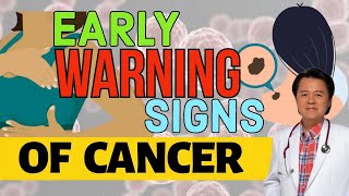 Early Warning Signs of Cancer  By Doctor Willie Ong  Internist amp Cardiologist [upl. by Derry]