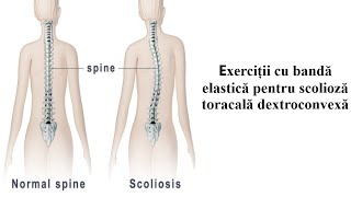 6 Exercitii pentru Scolioza Toracala Dreapta [upl. by Fidelis]