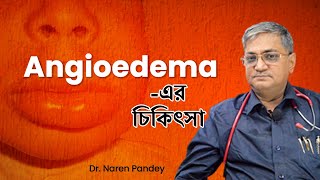 Angioedema  What is Angioedema in Bengali  এনজিওইডিমা কি  Dr Naren Pandey [upl. by Alisander519]