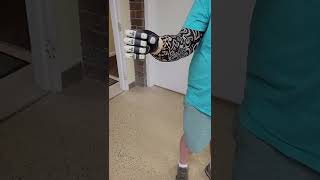 TASKA® Prosthetic Hand with CoApt Pattern Recognition System [upl. by Selec]